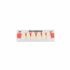 Acrotone Upper Anterior