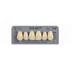 Vita MFT Upper Anteriors
