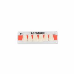 Acrotone Upper Anterior