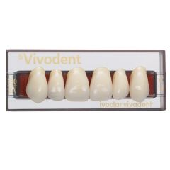 Vivodent SR Upper Anteriors