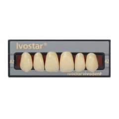 Ivostar Upper Anterior