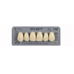 Vita MFT Upper Anteriors